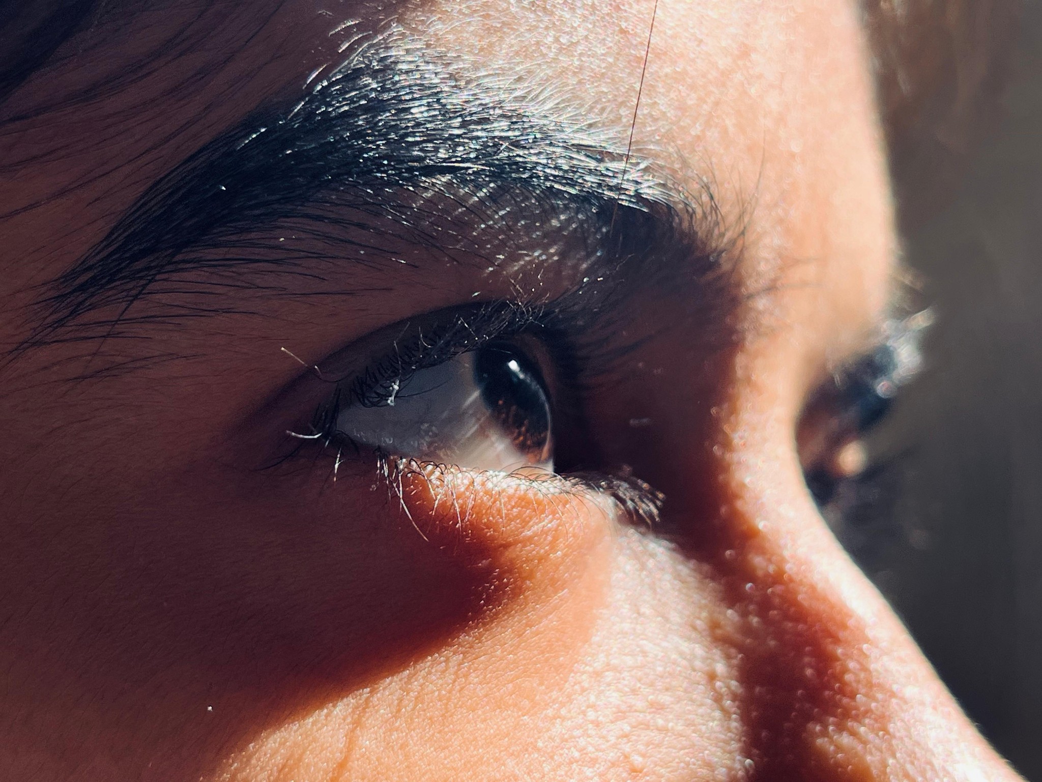 Eye