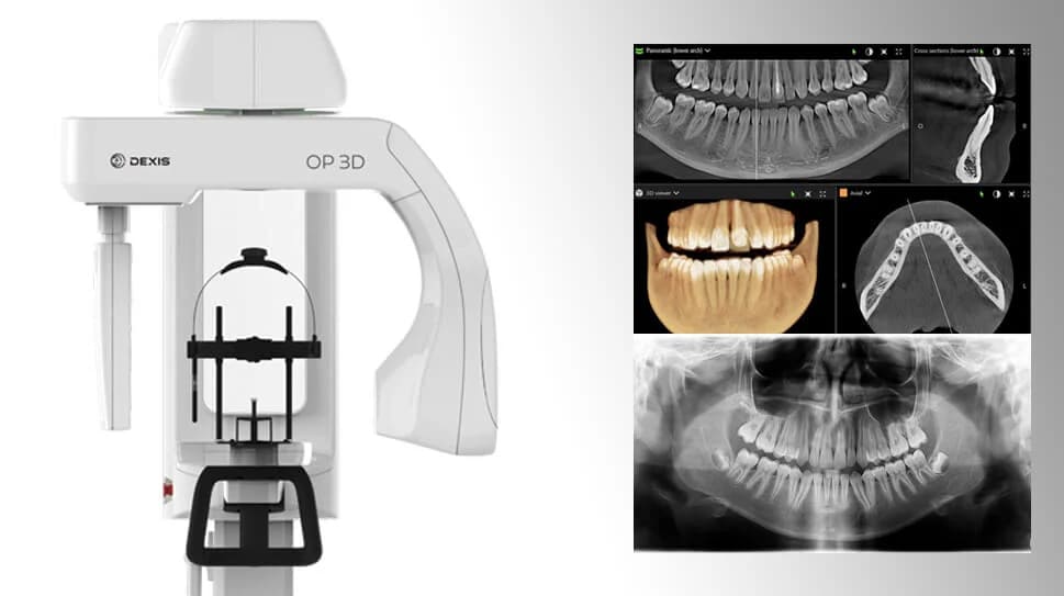Panorex Digital X-Ray machine at Midtown Dental Studio on Eglinton in Midtown Toronto, Ontario | Best Dentist in Midtown Toronto, Ontario