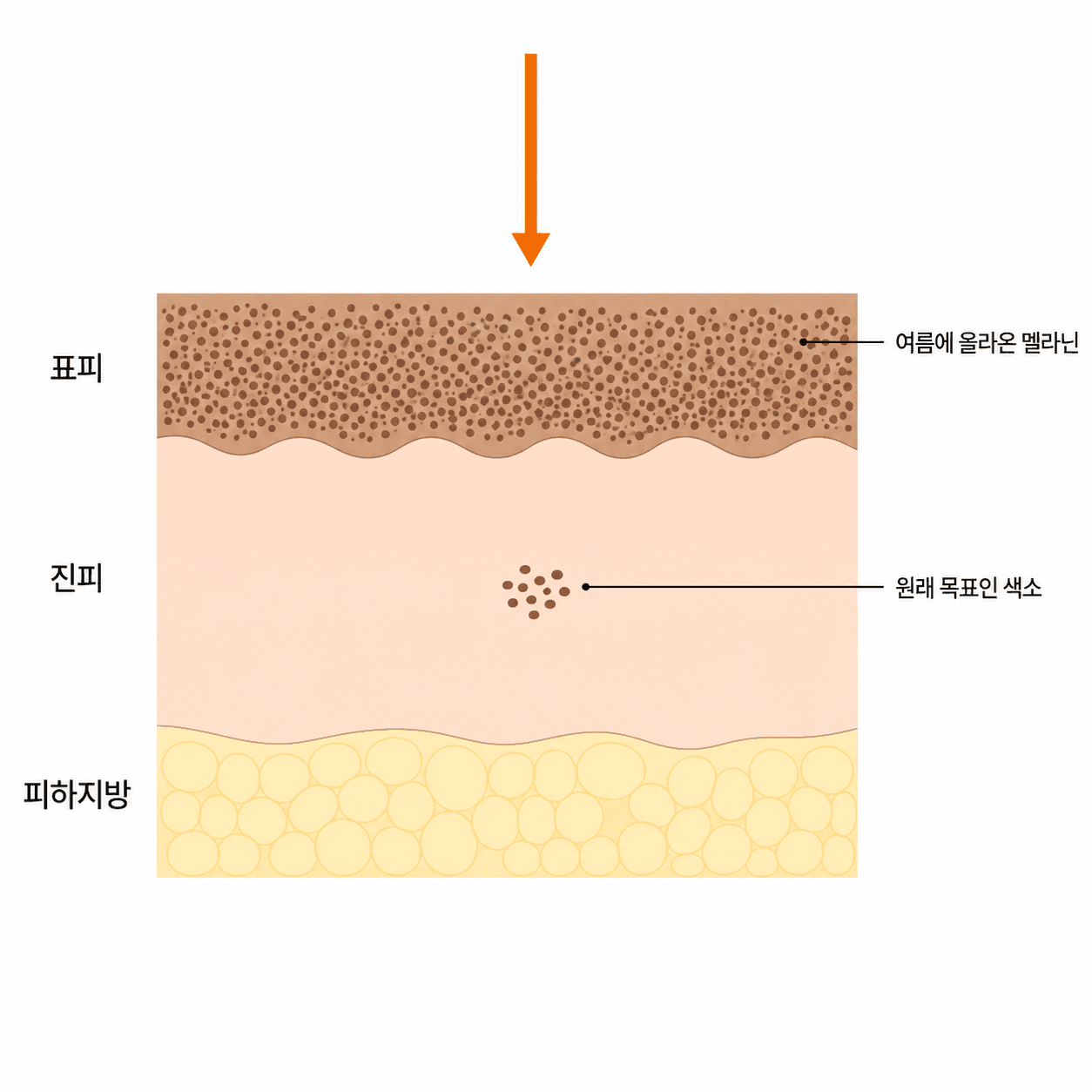 위층 멜라닌이 짙으면 에너지가 목표 색소까지 닿기 전에 소모돼요.