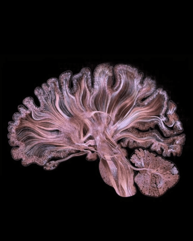 a drawing of a spider