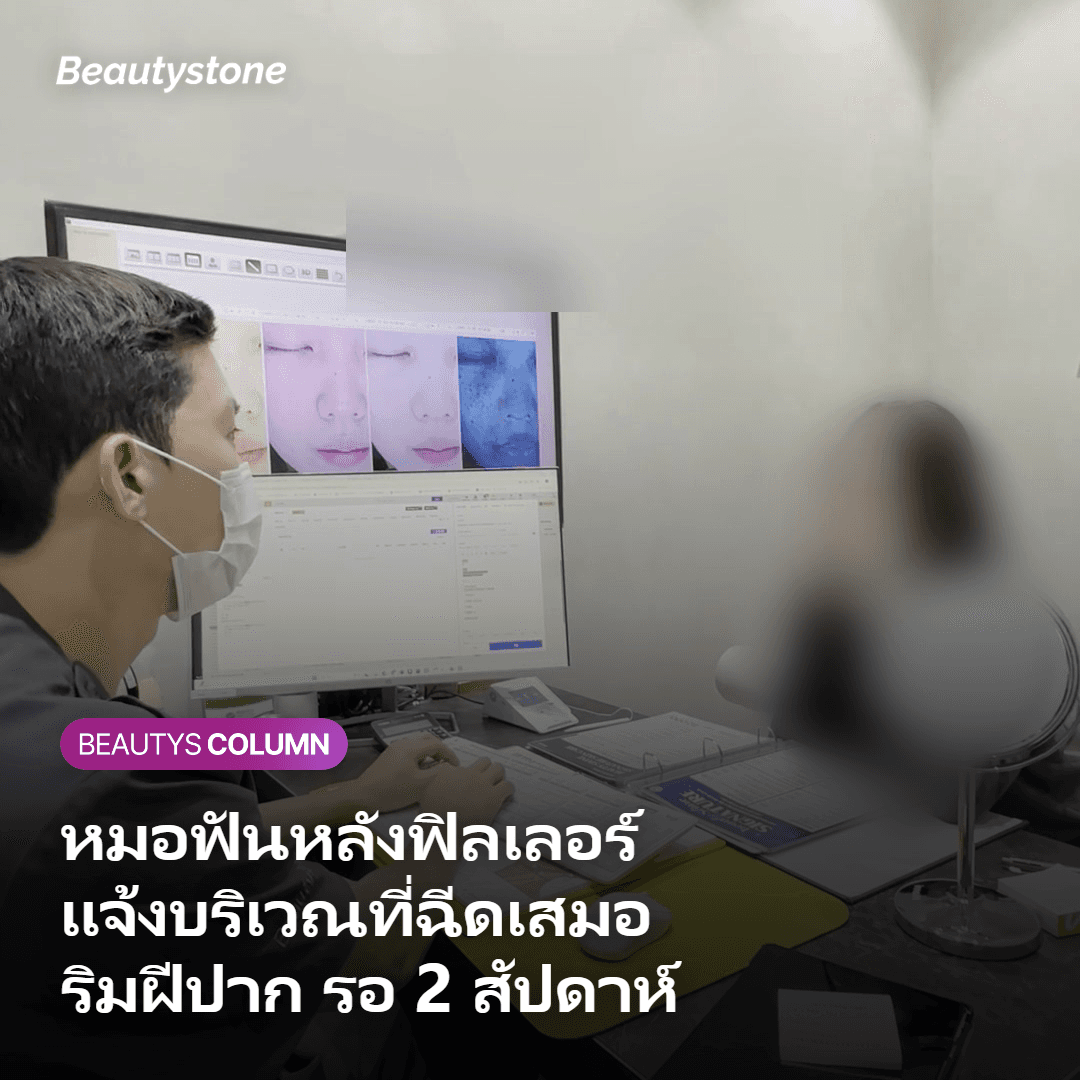 ตารางข้อห้ามและระยะเวลาที่ต้องรอหลังฉีดฟิลเลอร์
