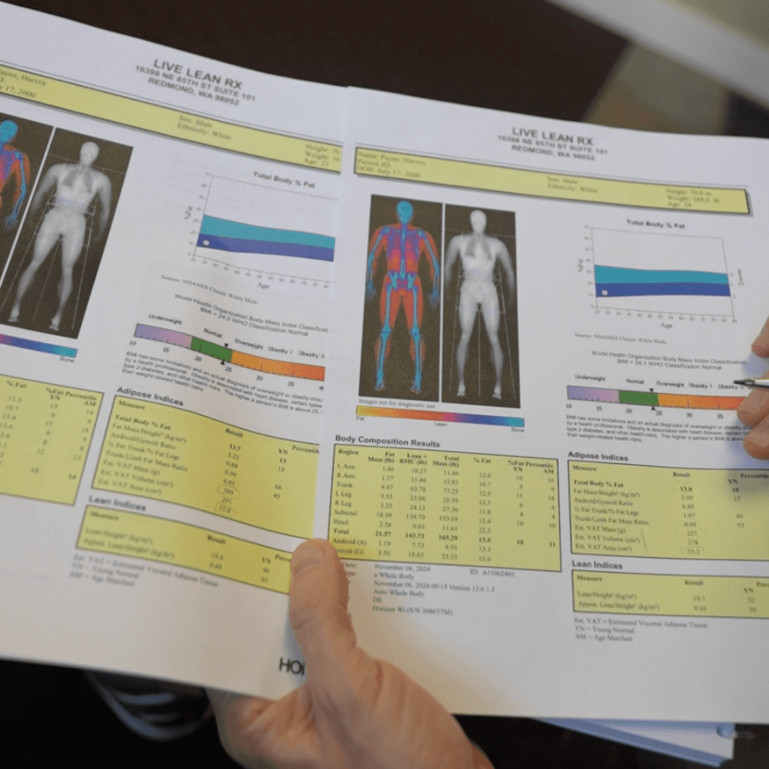 image of dexa scan results