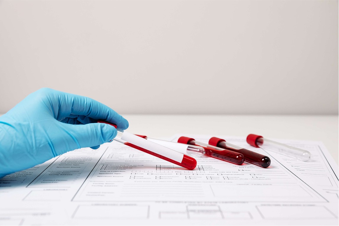 Blood test