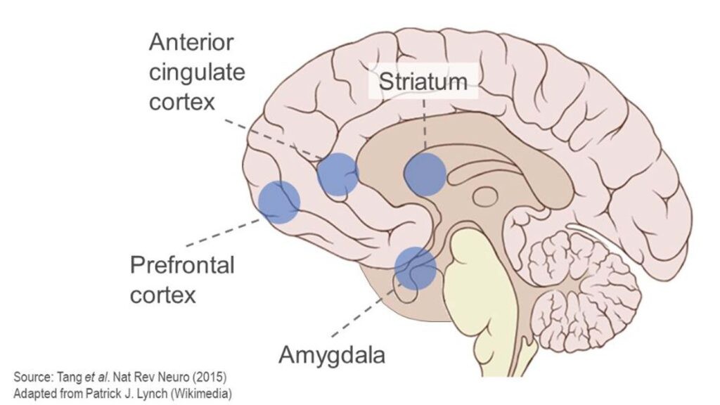 Brain regions affected by mindfulness meditation