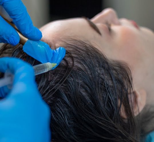 Medical Treatments for Hair Loss