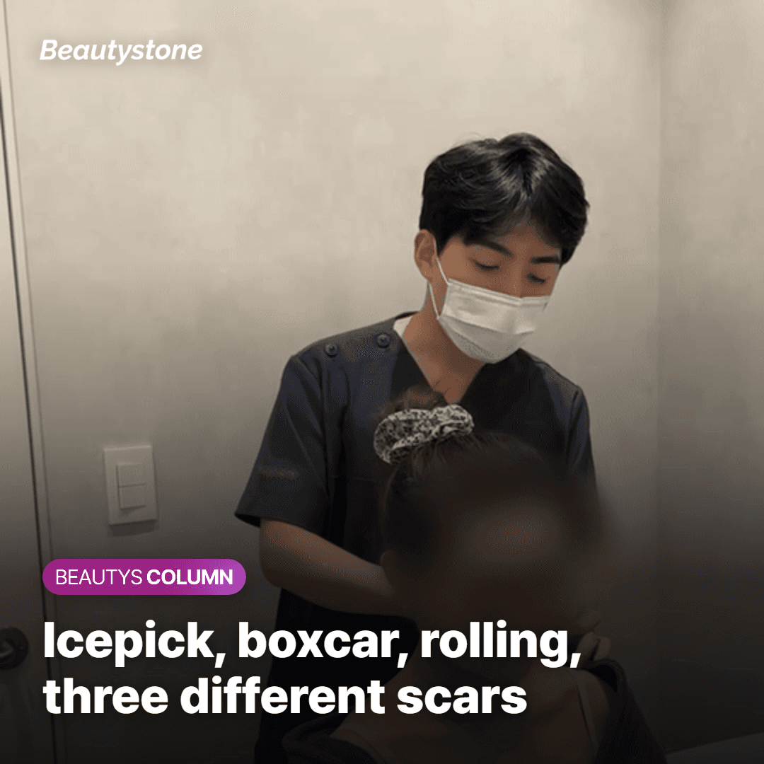 Three pitted acne scar shapes shown at different skin depths