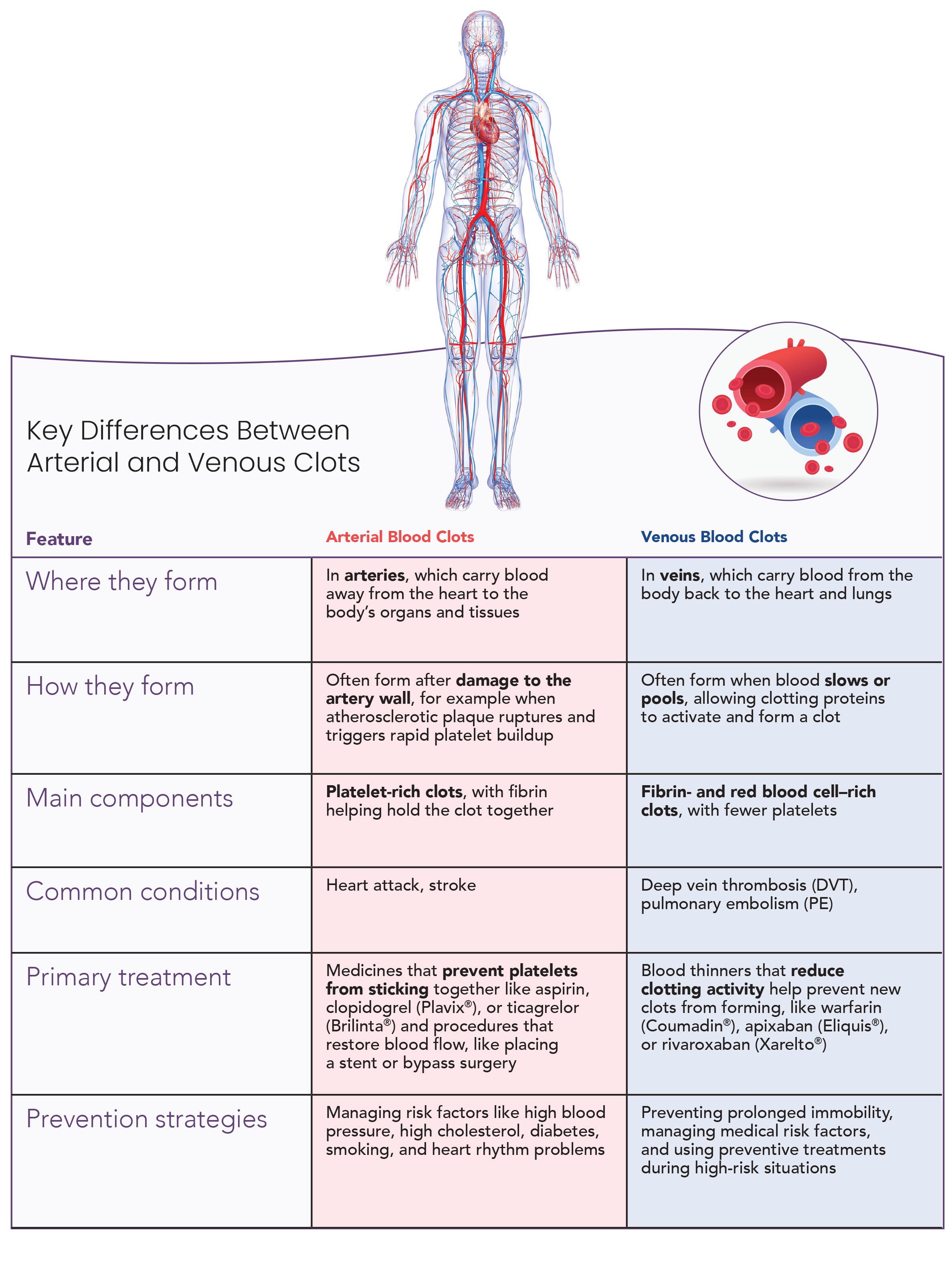 Comparison of arterial vs venous blood clots showing where they form, how they form, and main differences
