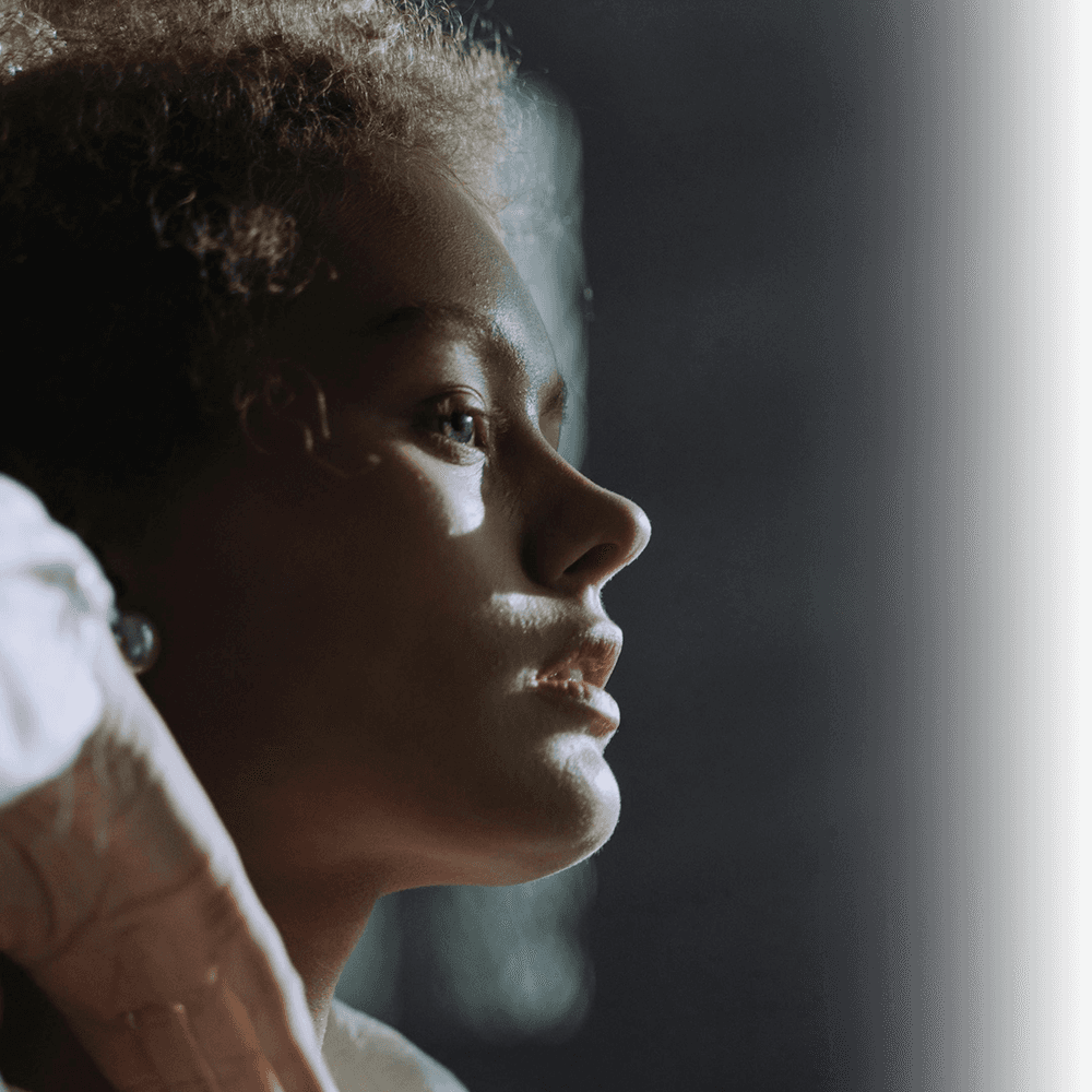 revizyon rinoplasti sonrası iyi projeksiyonlu bir burun