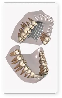 Vizualizare detaliată 3D a danturii pentru planificarea tratamentului dentar în dROOT
