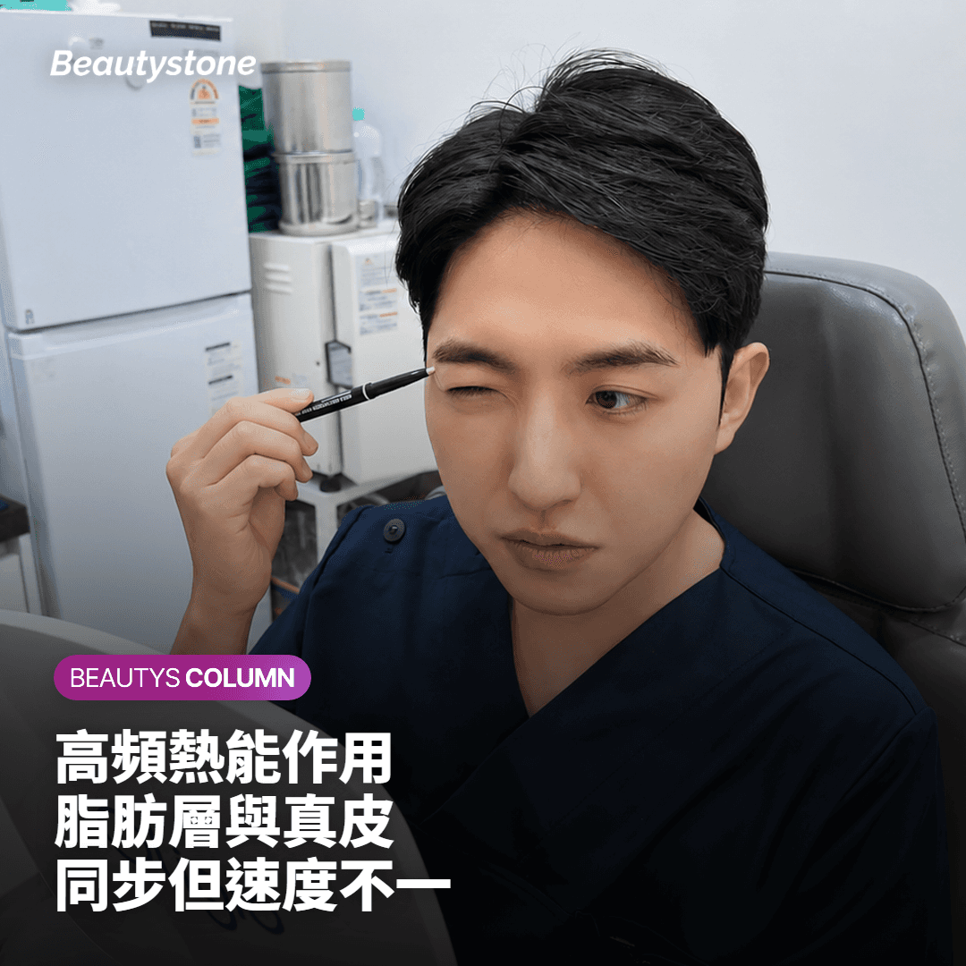 InMode FX的高頻熱能是怎麼作用在皮膚下方的