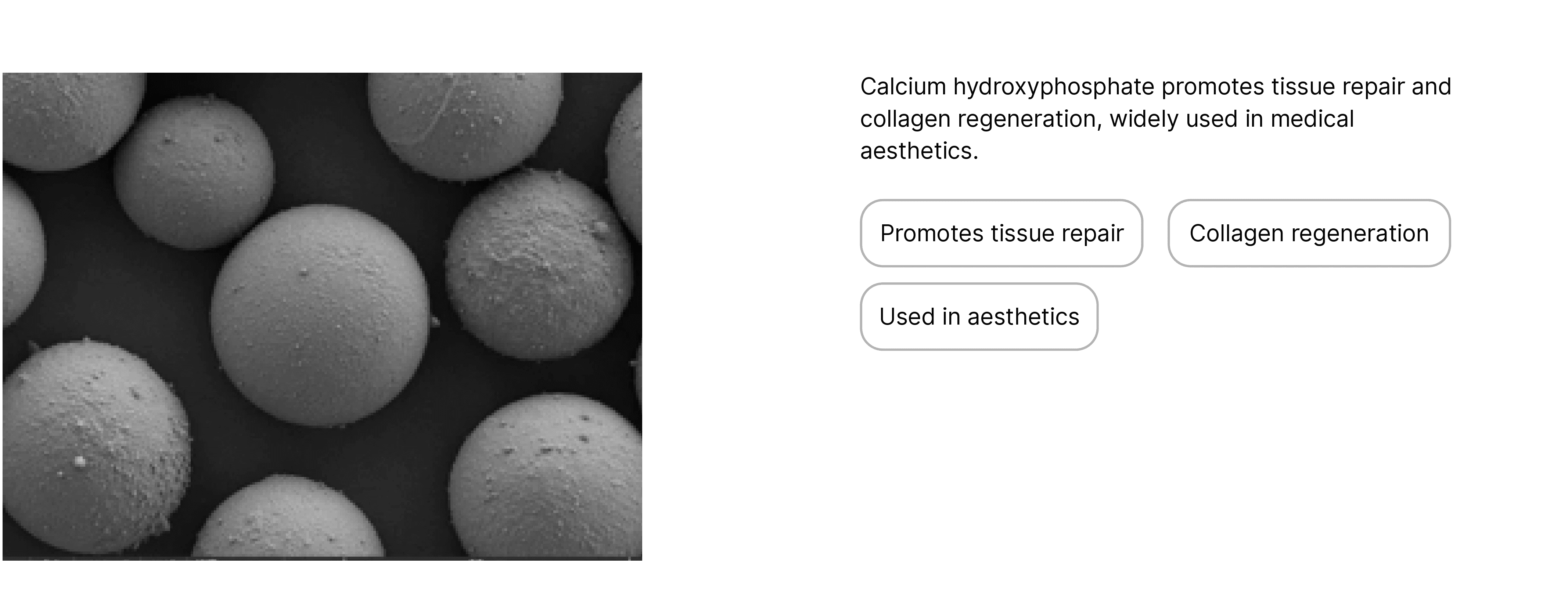 High-Purity Hydroxyapatite Microsphere Fillers for Aesthetic and Regenerative Applications