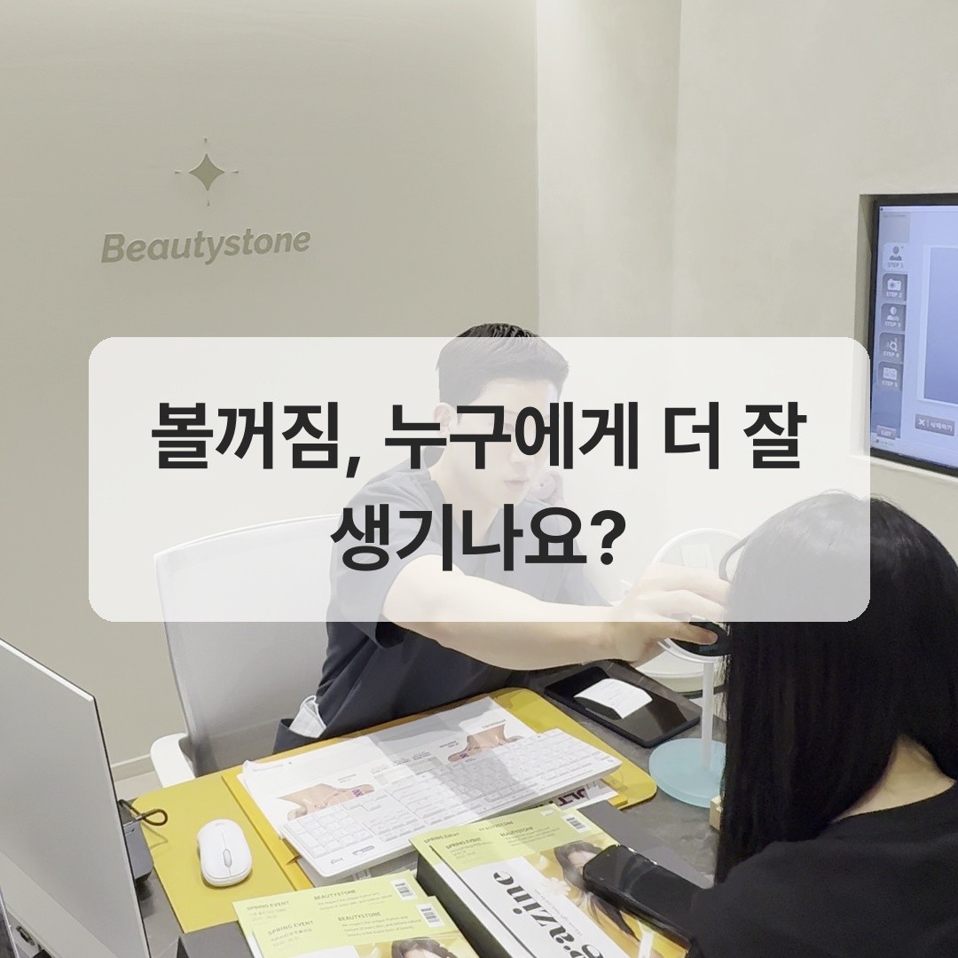 교근 보톡스 후 볼 지지 구조 변화 도식