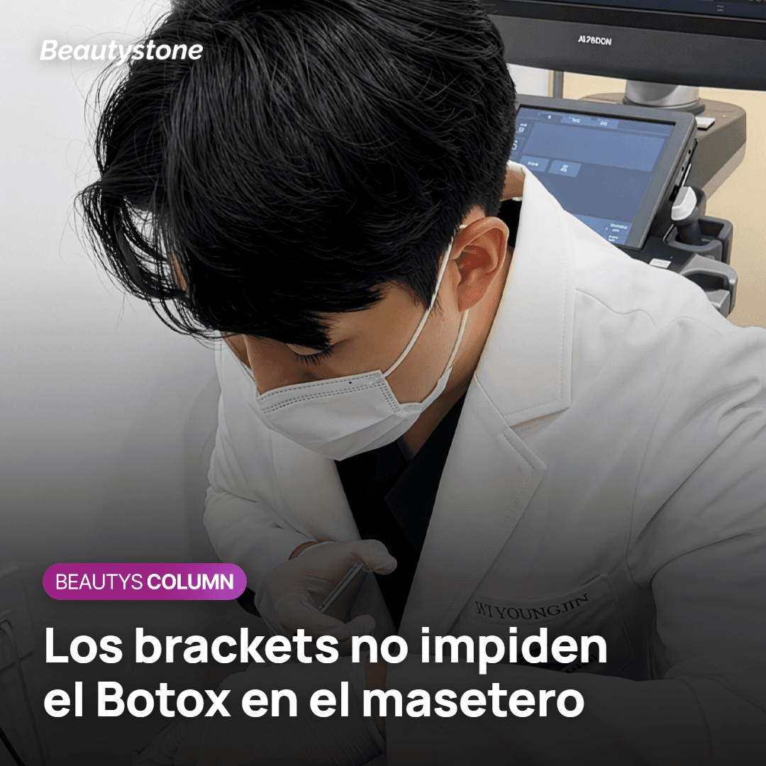 Botox en el masetero en una persona que lleva brackets