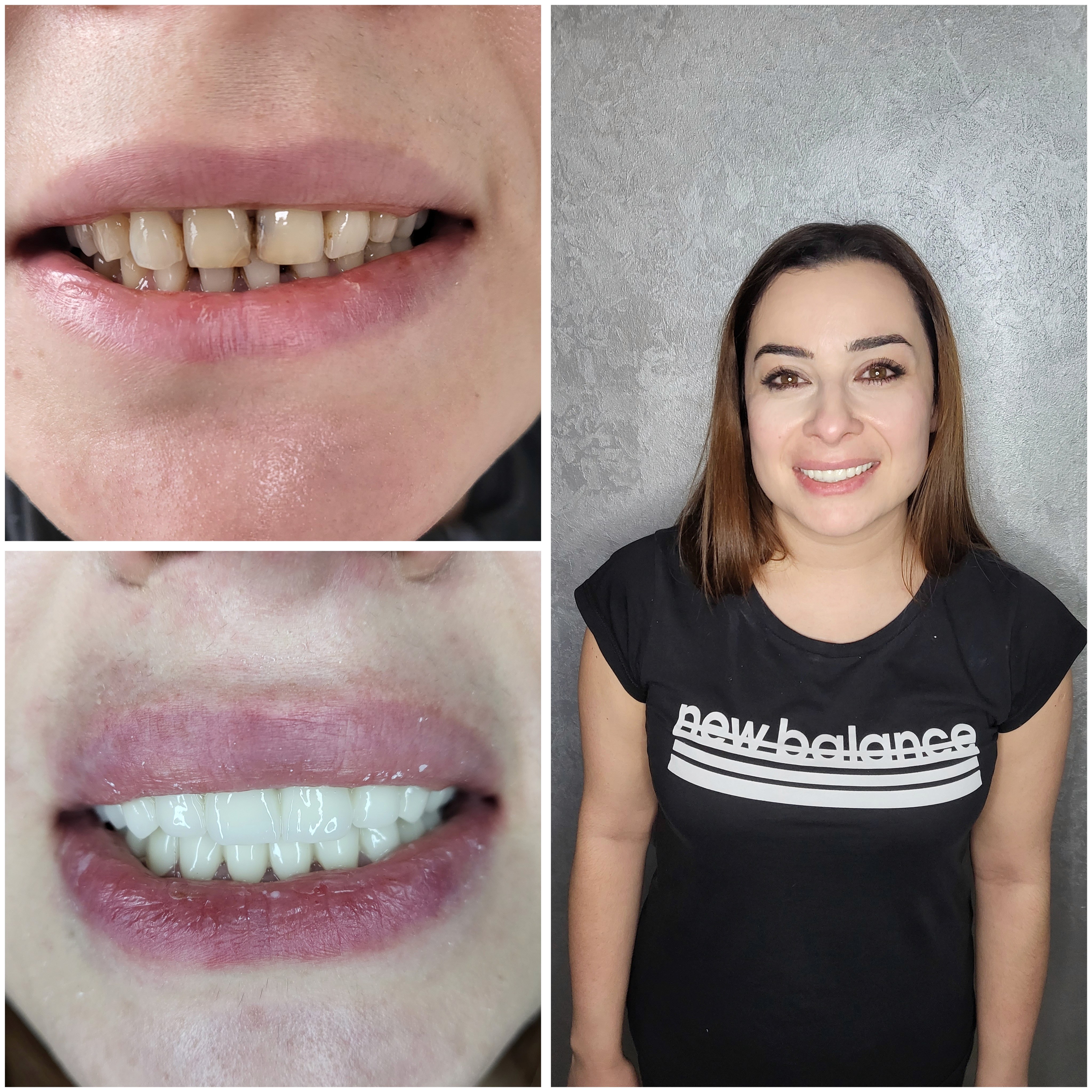 Beautiful woman smiling with her hands on her cheeks