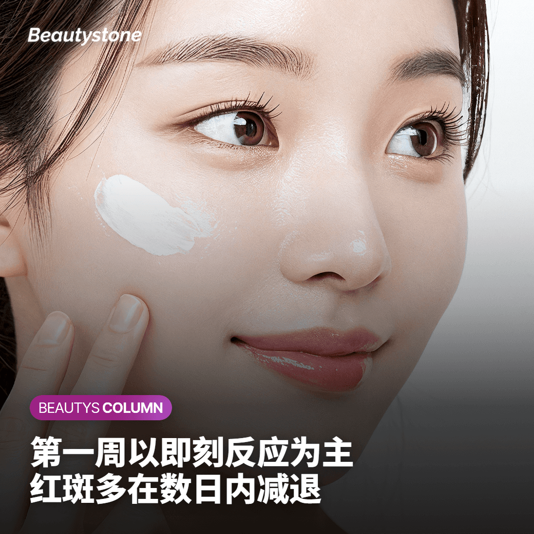 示意卡片，列出治疗后第一周红斑与温热感的变化
