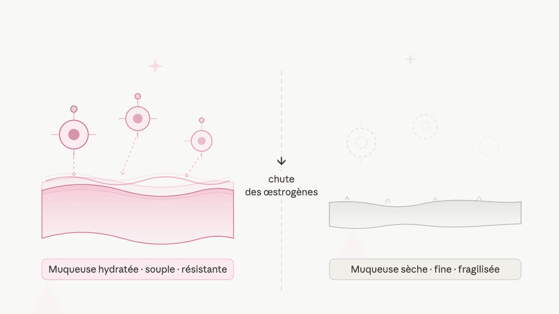 La sécheresse vaginale liée à la ménopause