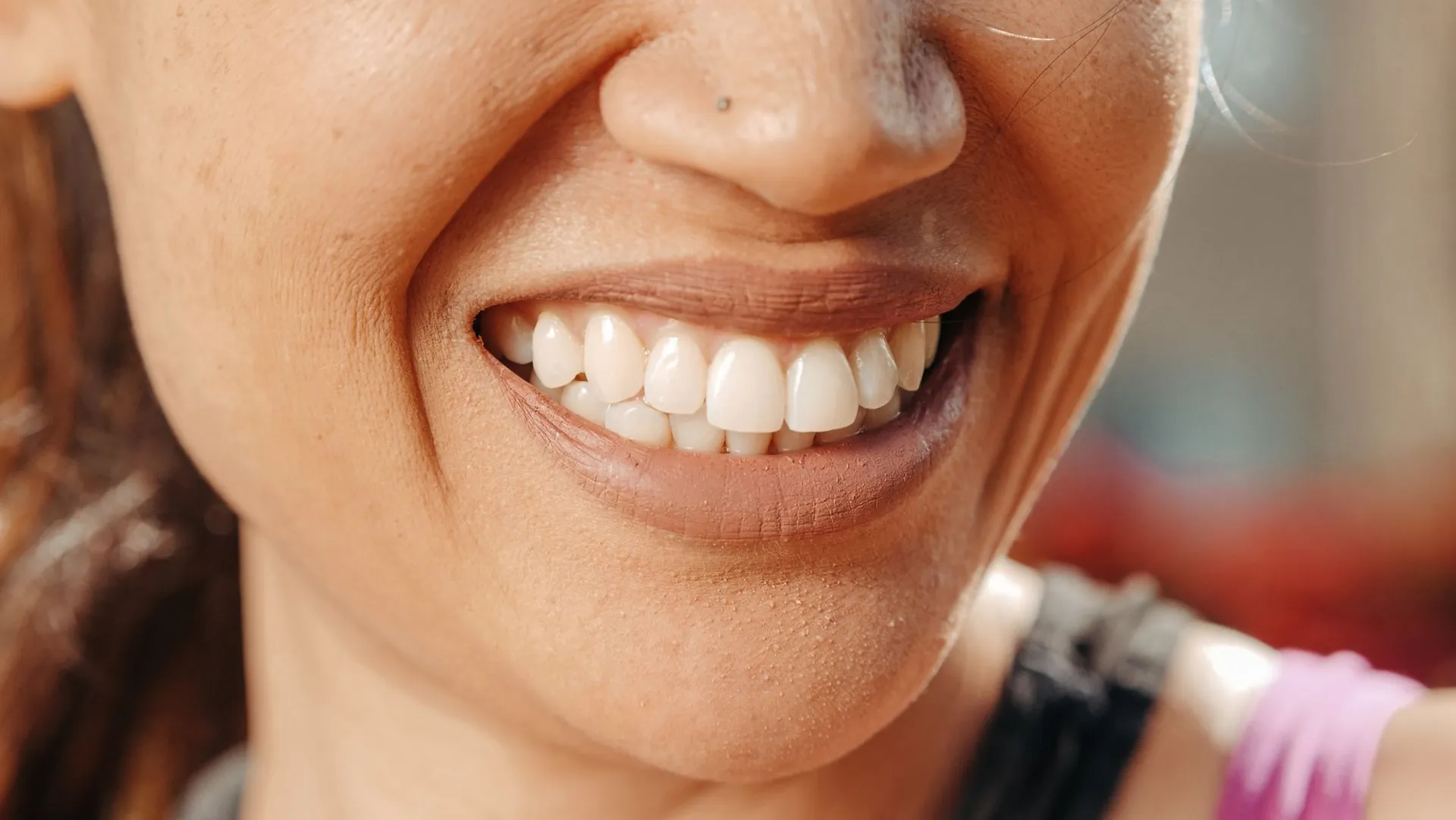 a young woman smiling showing teeth
