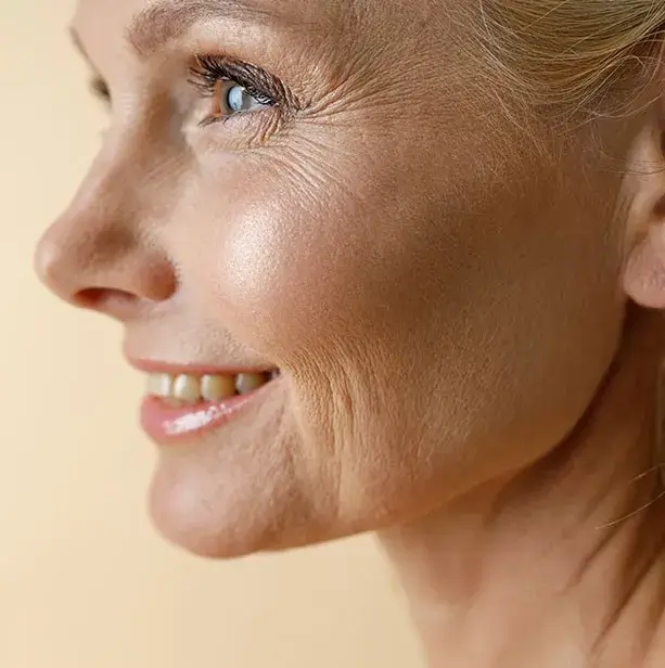 Woman smiling after Botox injection for dynamic wrinkle reduction, showing smoother skin and natural facial rejuvenation results.