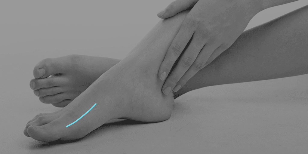 Schnittführung beikonventioneller Hallux-valgus-OP