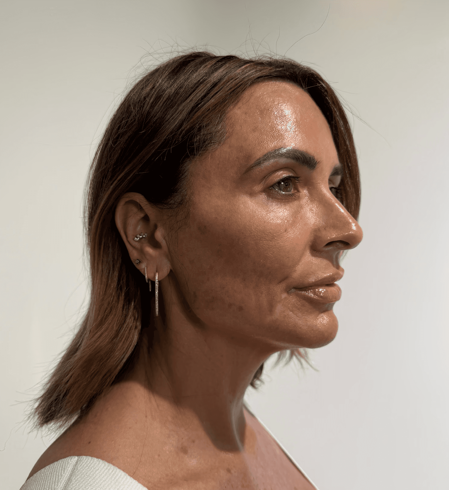 Woman's skin after getting a facial