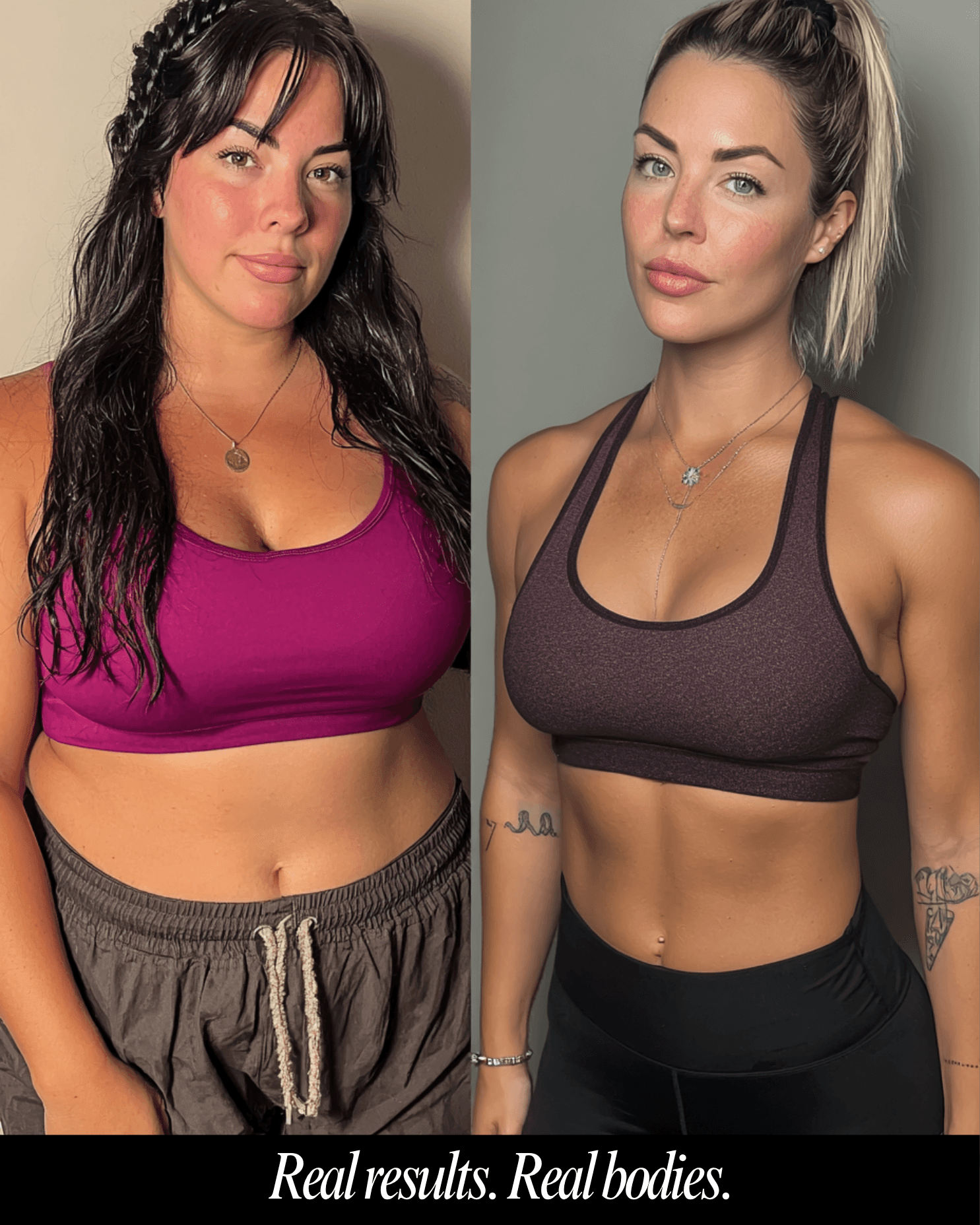 Man receiving Botox injection near the temple area as part of a migraine relief treatment designed to reduce chronic headache frequency and intensity.