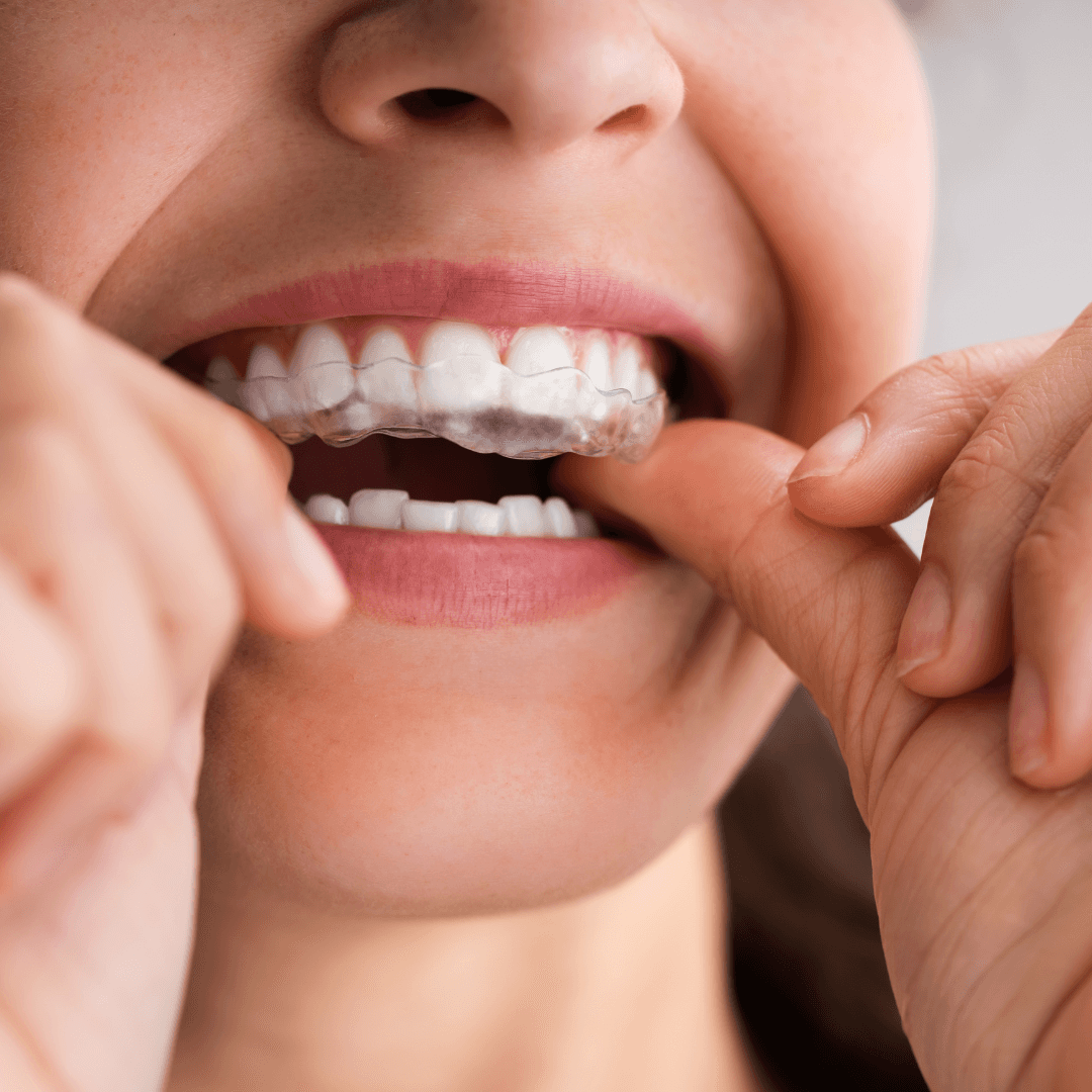 impact stress oral health 2025