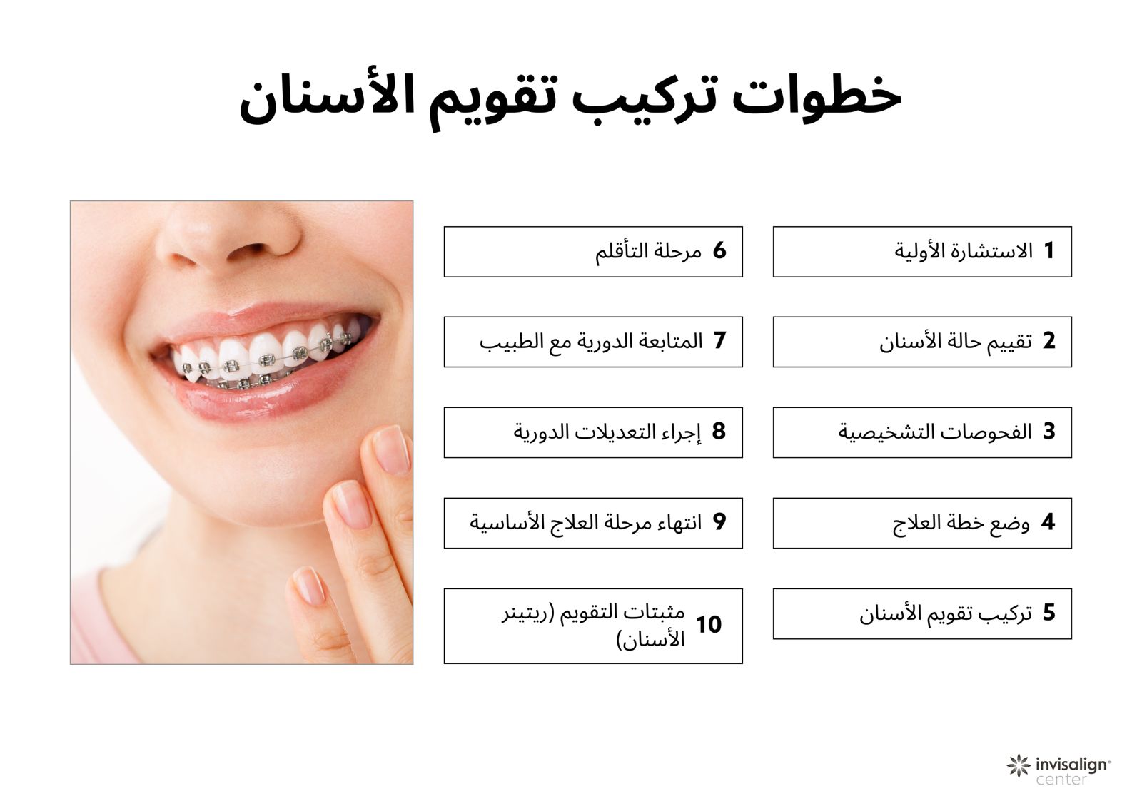 صورة توضيحية لعملية تركيب تقويم أسنان في دبي خطوة بخطوة.