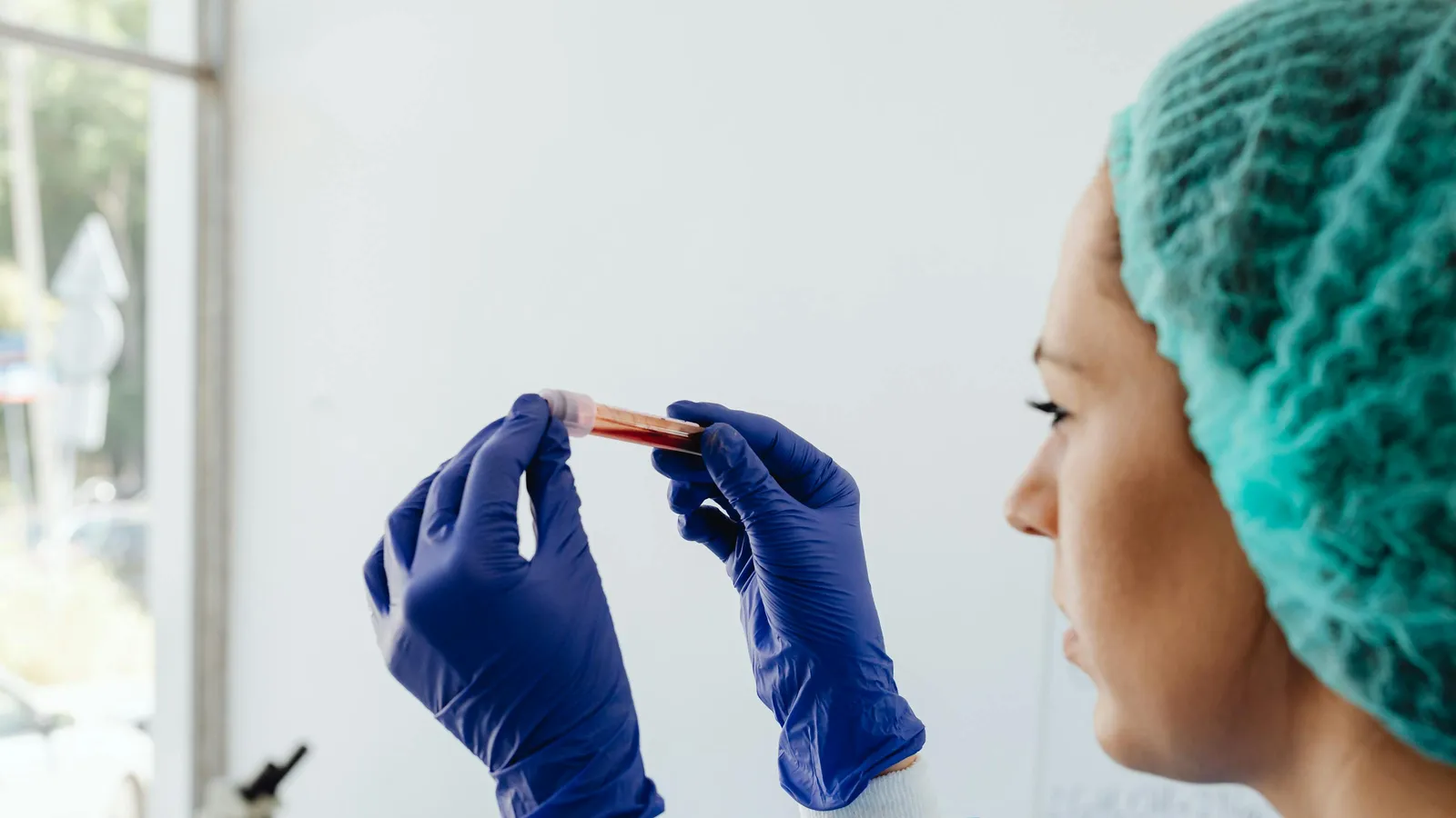 What Is a Normal Monocyte Count?