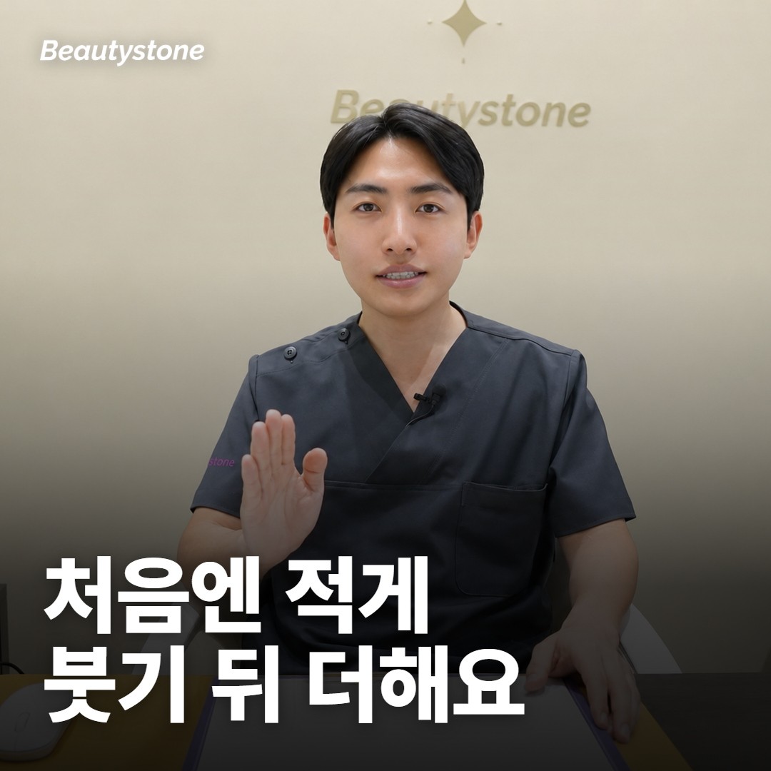 남자 이마는 얼마나 넣고, 효과는 얼마나 가나요?