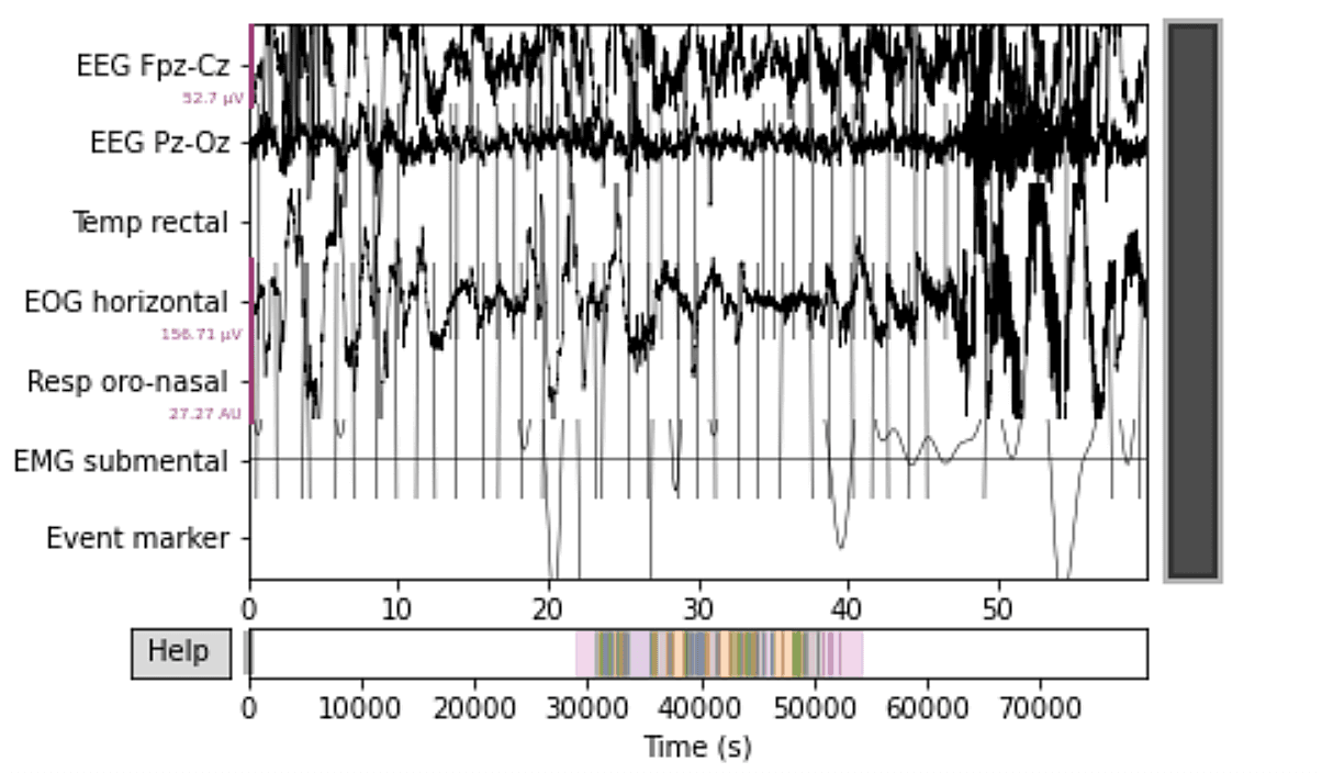 Example EDF PSG recording channels and signal values