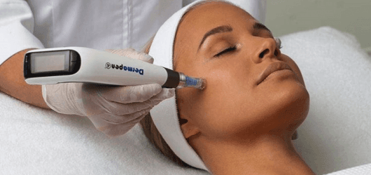 Mezoterapia mikroigłowa