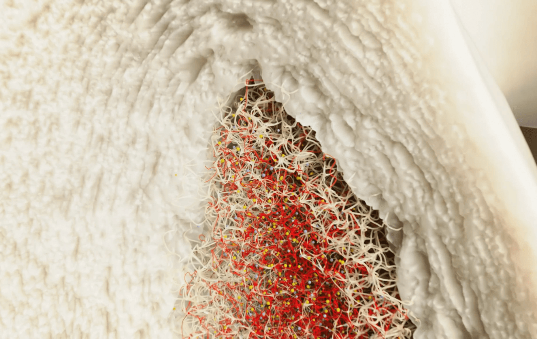Drug molecule separates from the delivery peptide and enters the cytoplasm