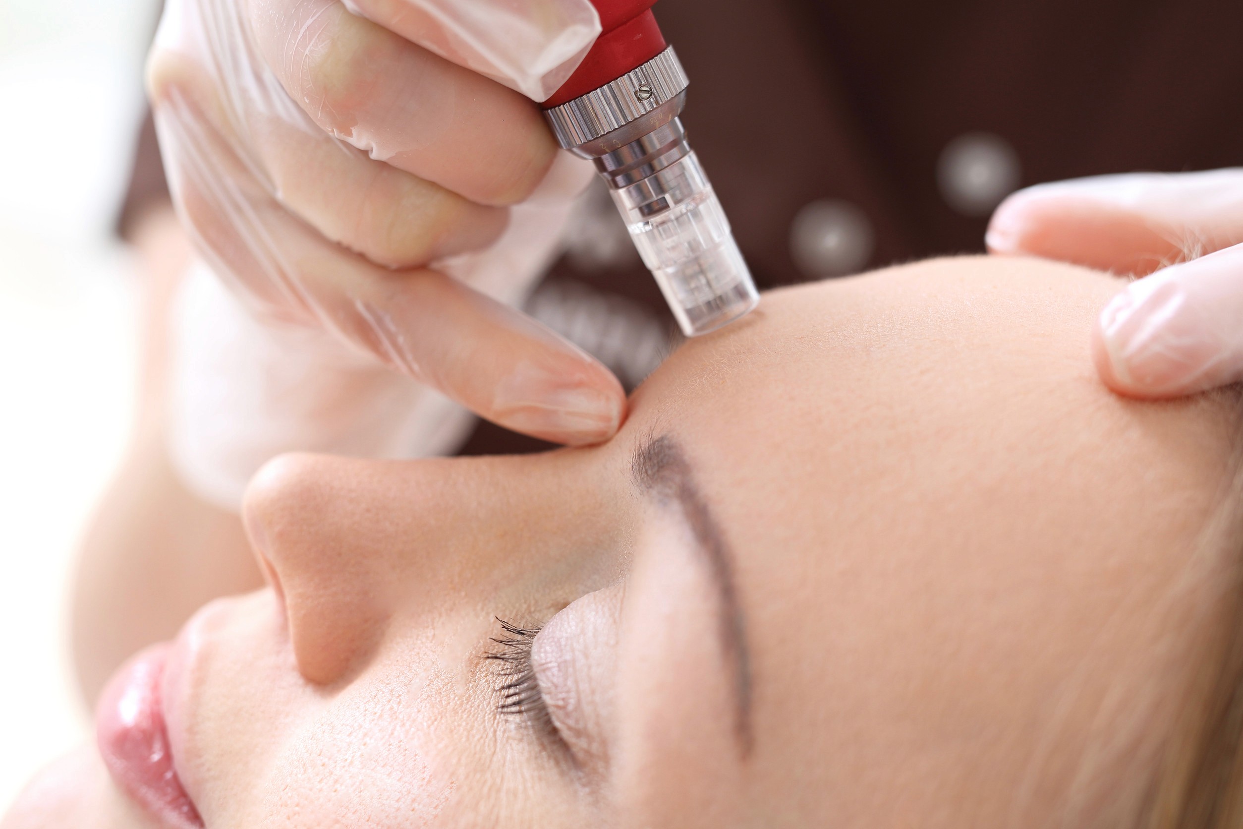 Rejuvenating Your Facial Skin with ANCR Glow