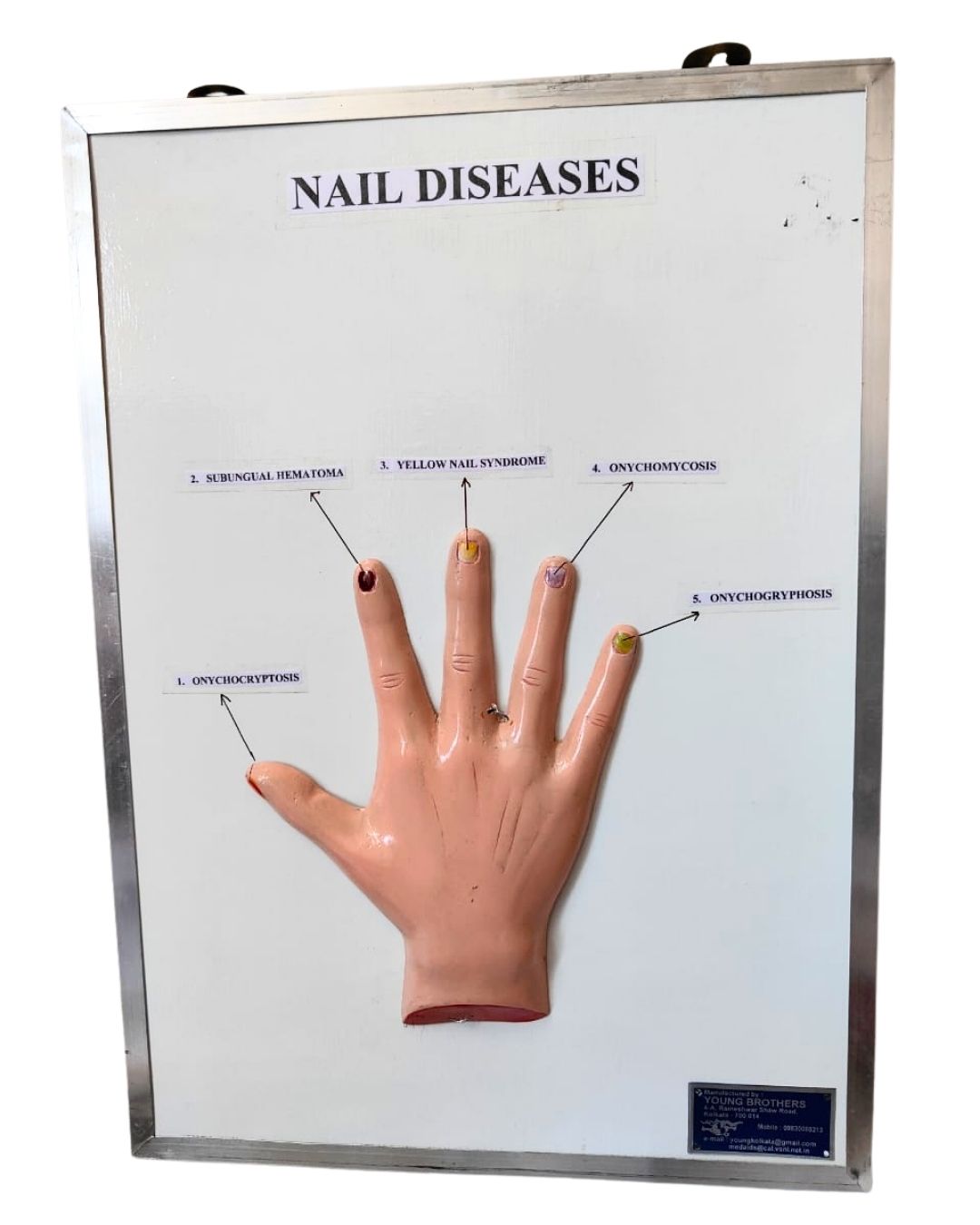 Nail Diseases