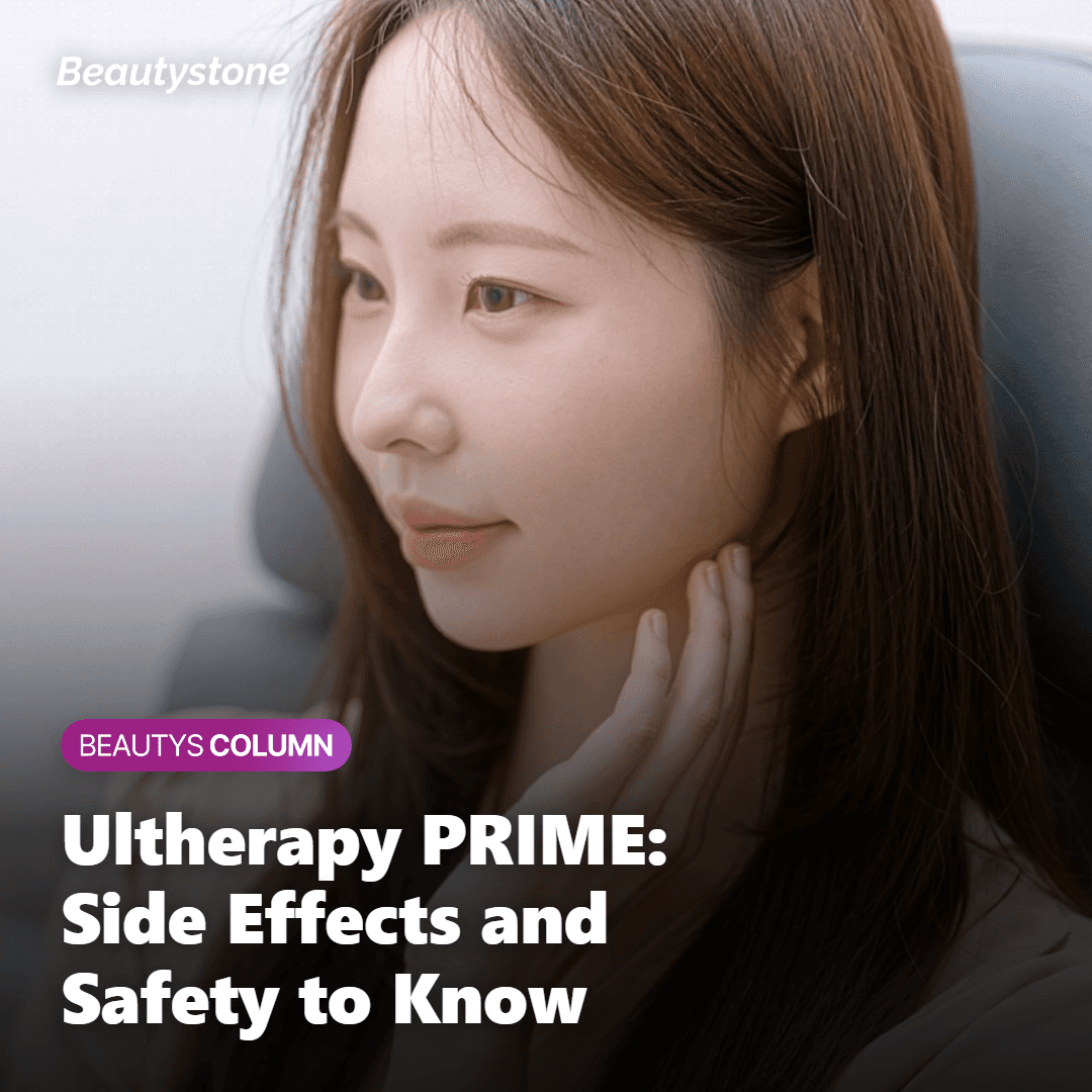Ultherapy PRIME focused ultrasound reaching the SMAS layer