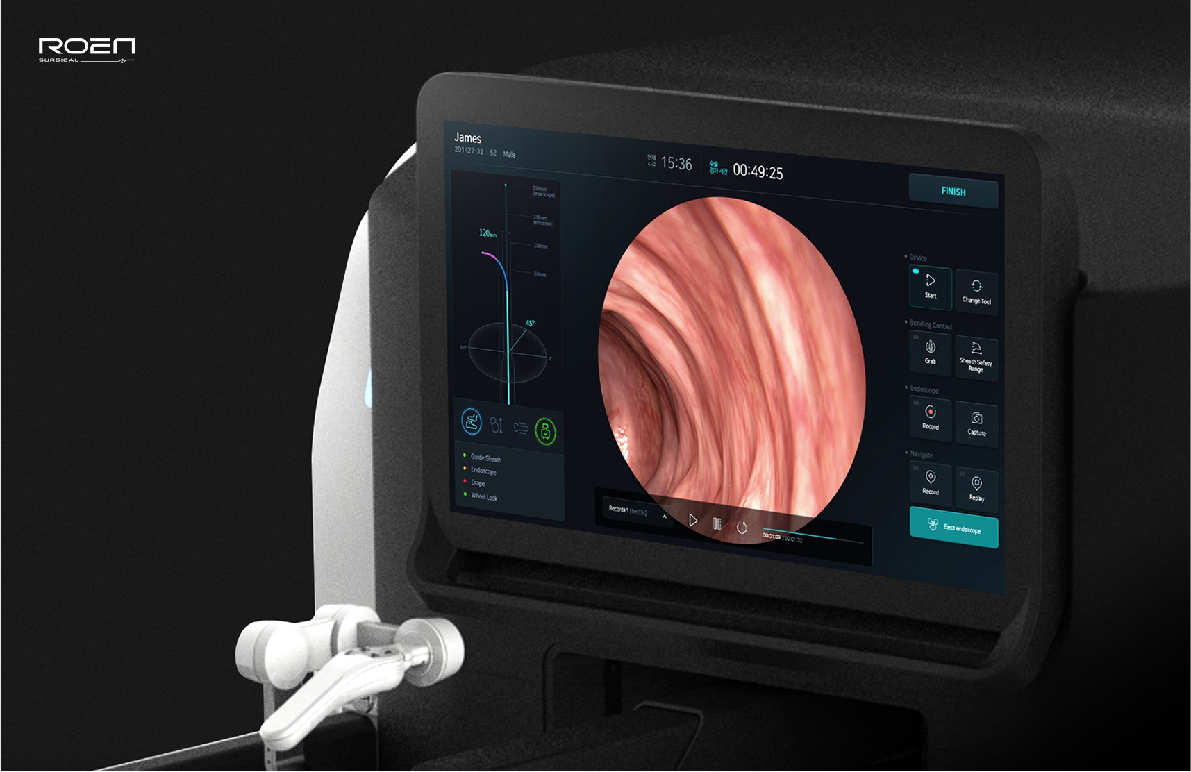 내시경 화면과 다양한 제어 패널이 함께 구성된 수술 장비 UI