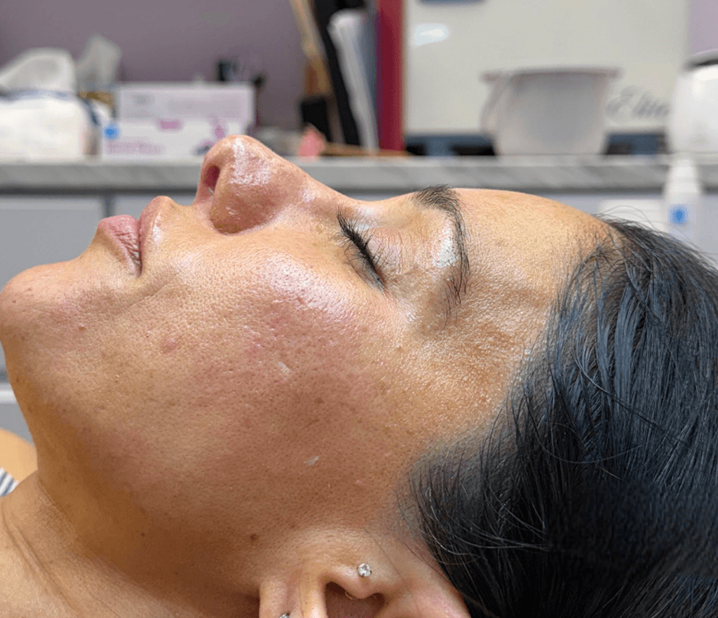 Glass Skin Facial Oyster Bay After