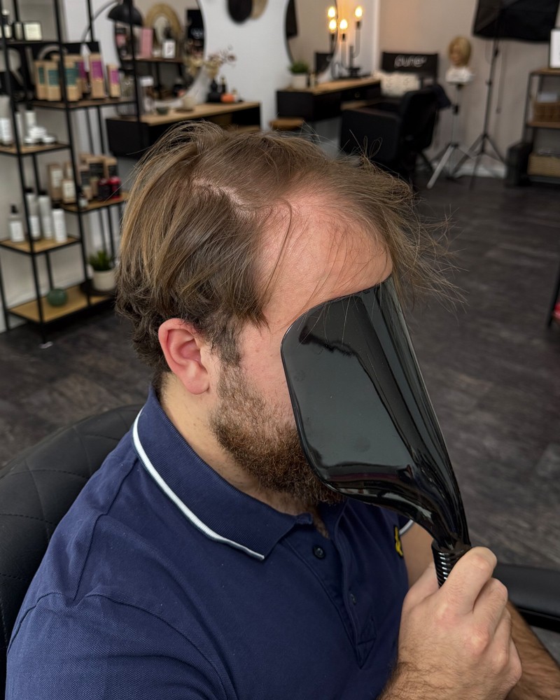 Cortese Haarsysteme - Vorher-Ansicht 2