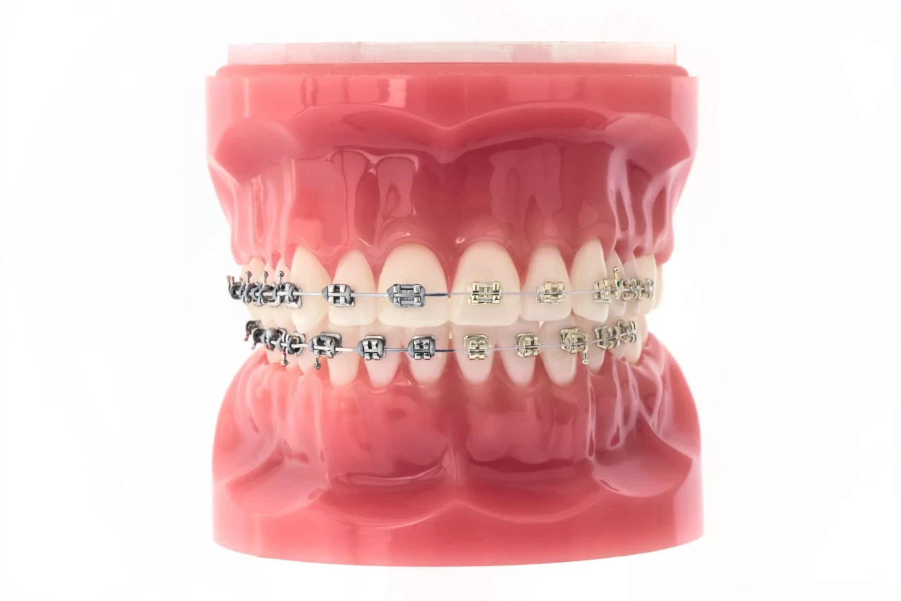 Wizualizacja implantów.