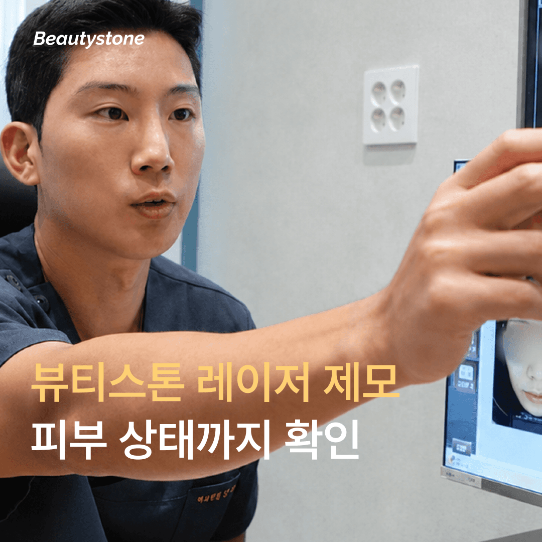 뷰티스톤 레이저 제모