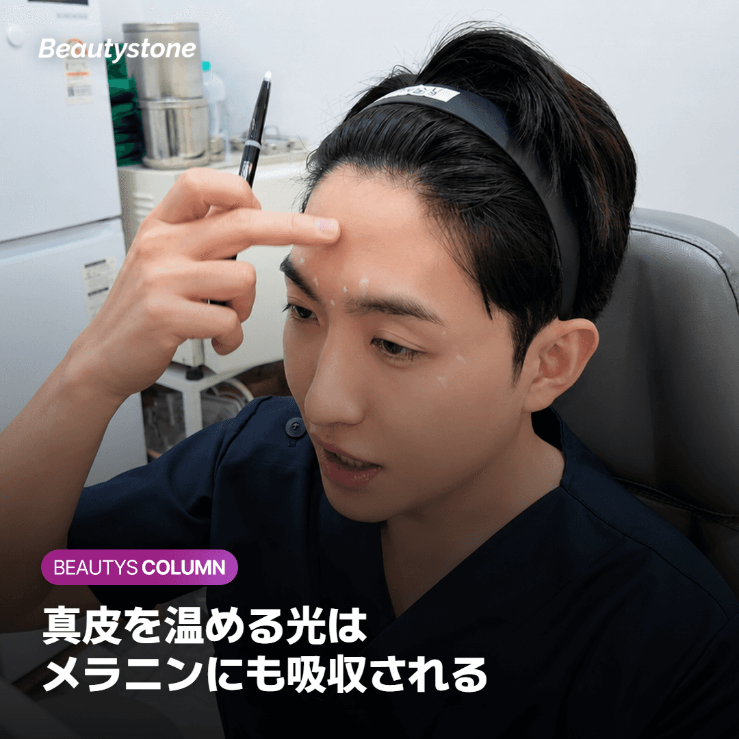 よくある副作用と、様子を見てよい経過の目安