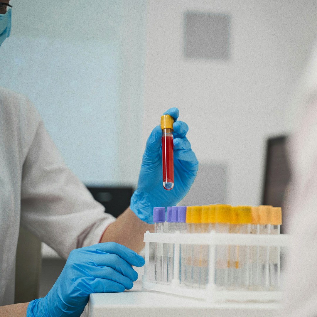 Close-up of a blood draw procedure.