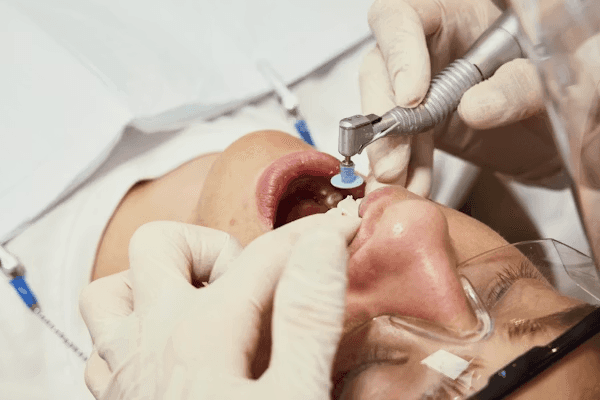 Lip Filler Treatment Being Performed