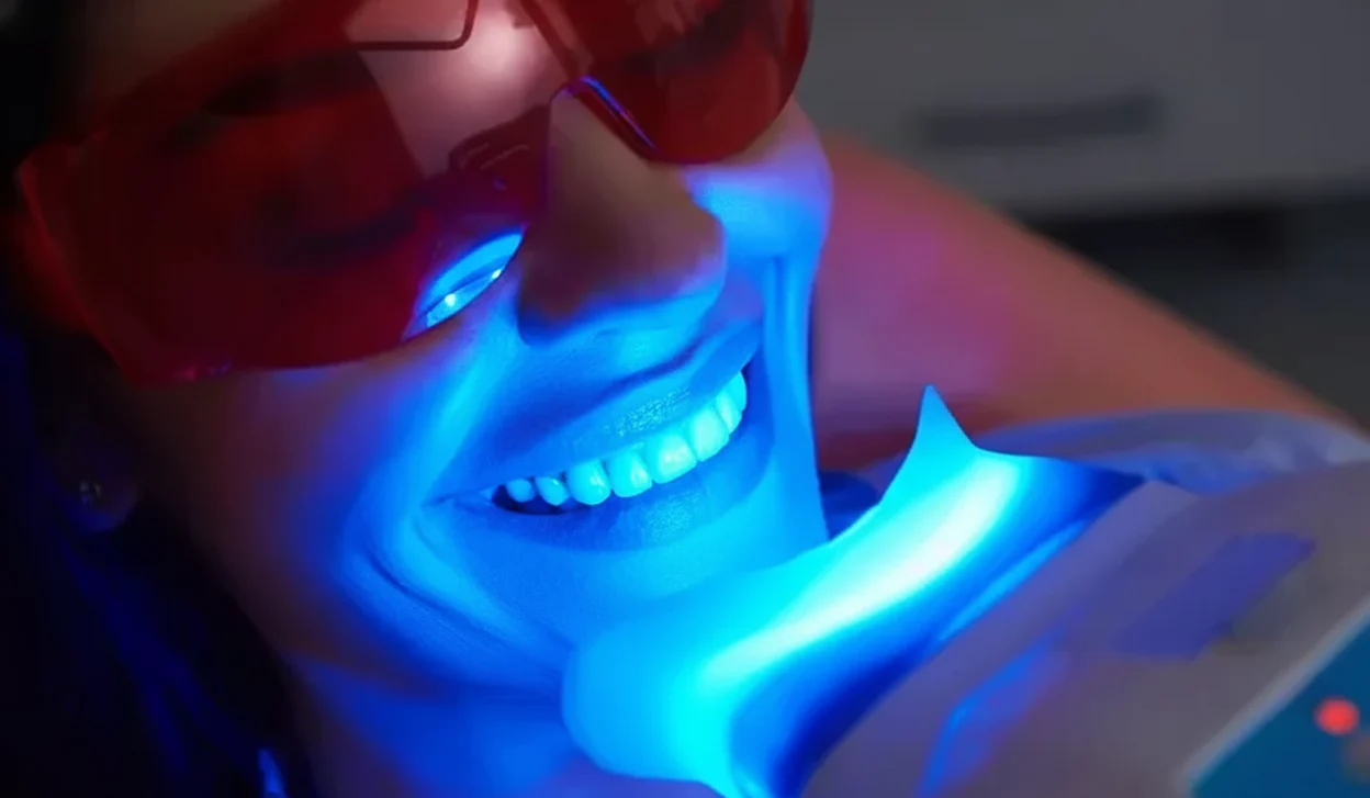 Close-up of teeth undergoing the Zoom whitening process