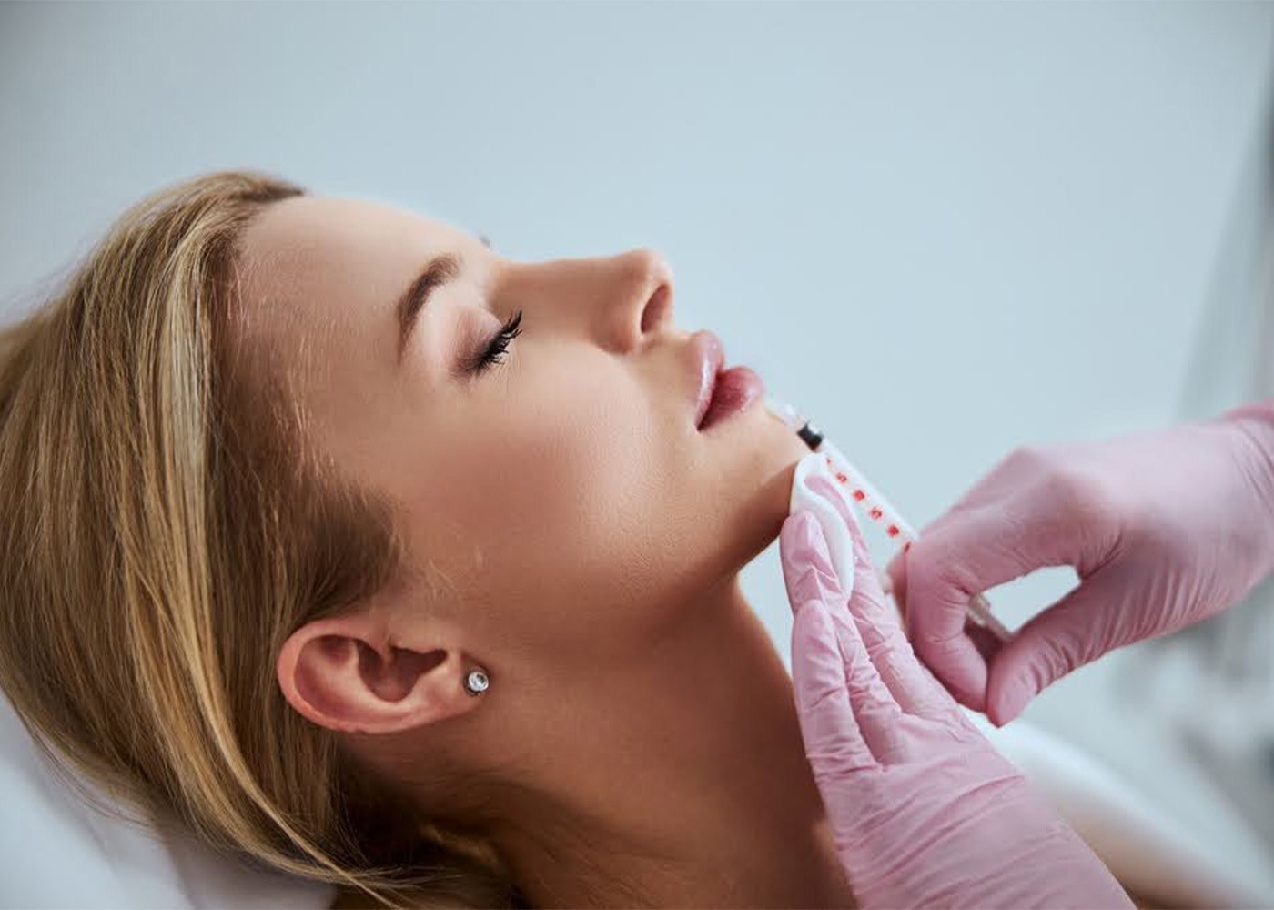 Licensed injector placing dermal filler with a needle—gloved hands, face marked for treatment.