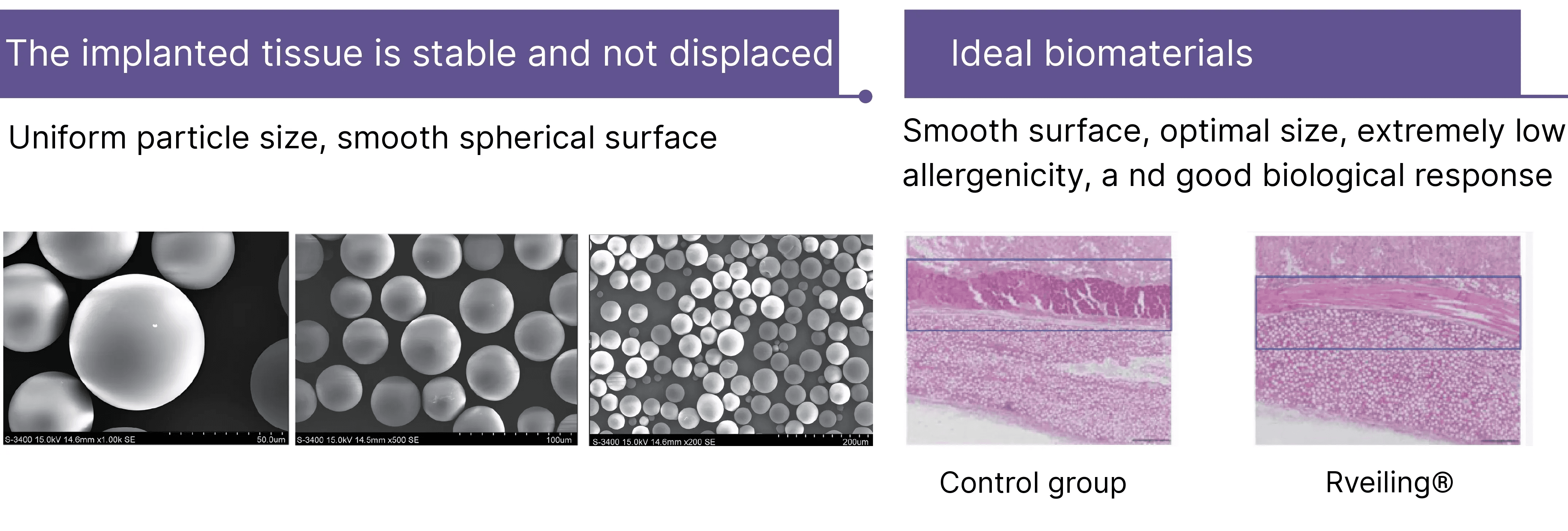 Rveiling® PLLA-PEG Microsphere Particles in Tissue Following Implantation