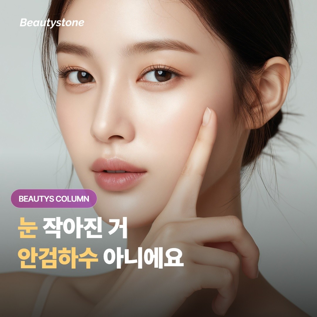 이마 보톡스 맞고 눈 작아진 거, 안검하수 아니에요