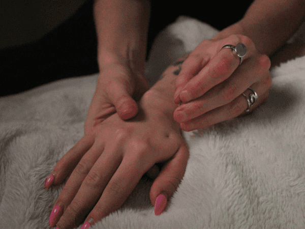 Hand acupuncture on a patient's hand
