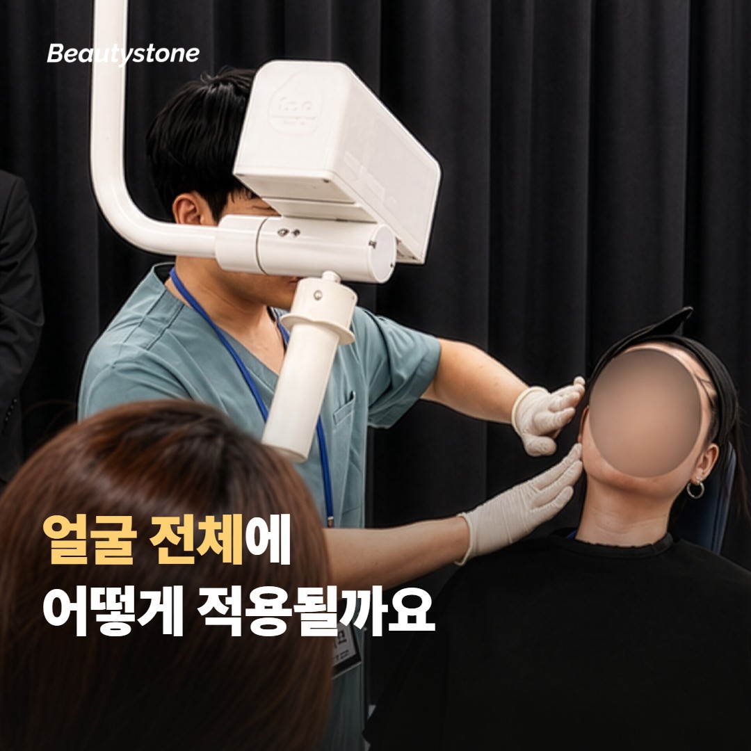 티타늄 리프팅이 얼굴 전체에 적용되는 방식