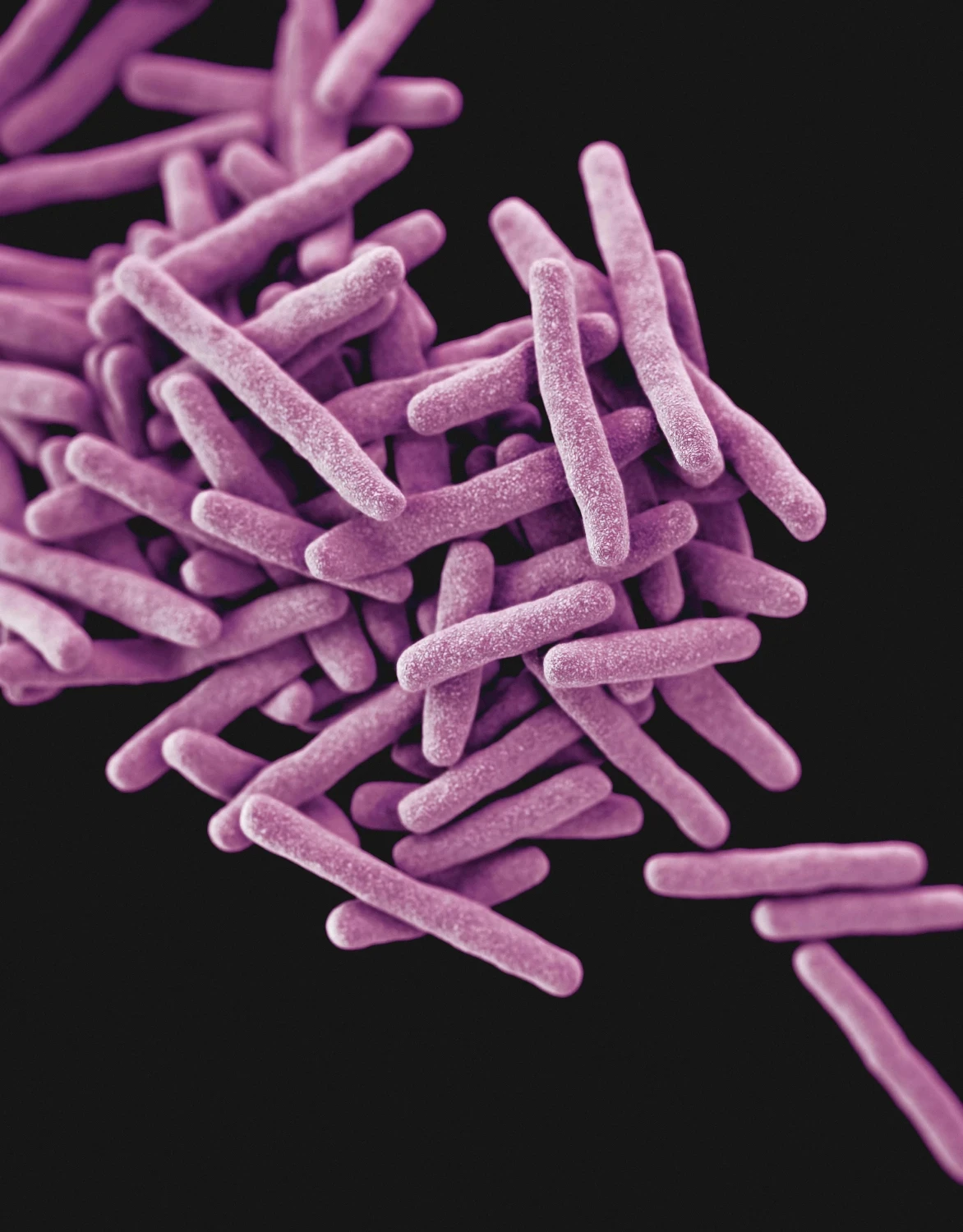 Characterization of a 4.2-kb plasmid isolated from periodontopathic spirochetes | Bloor-Yorkville Periodontics